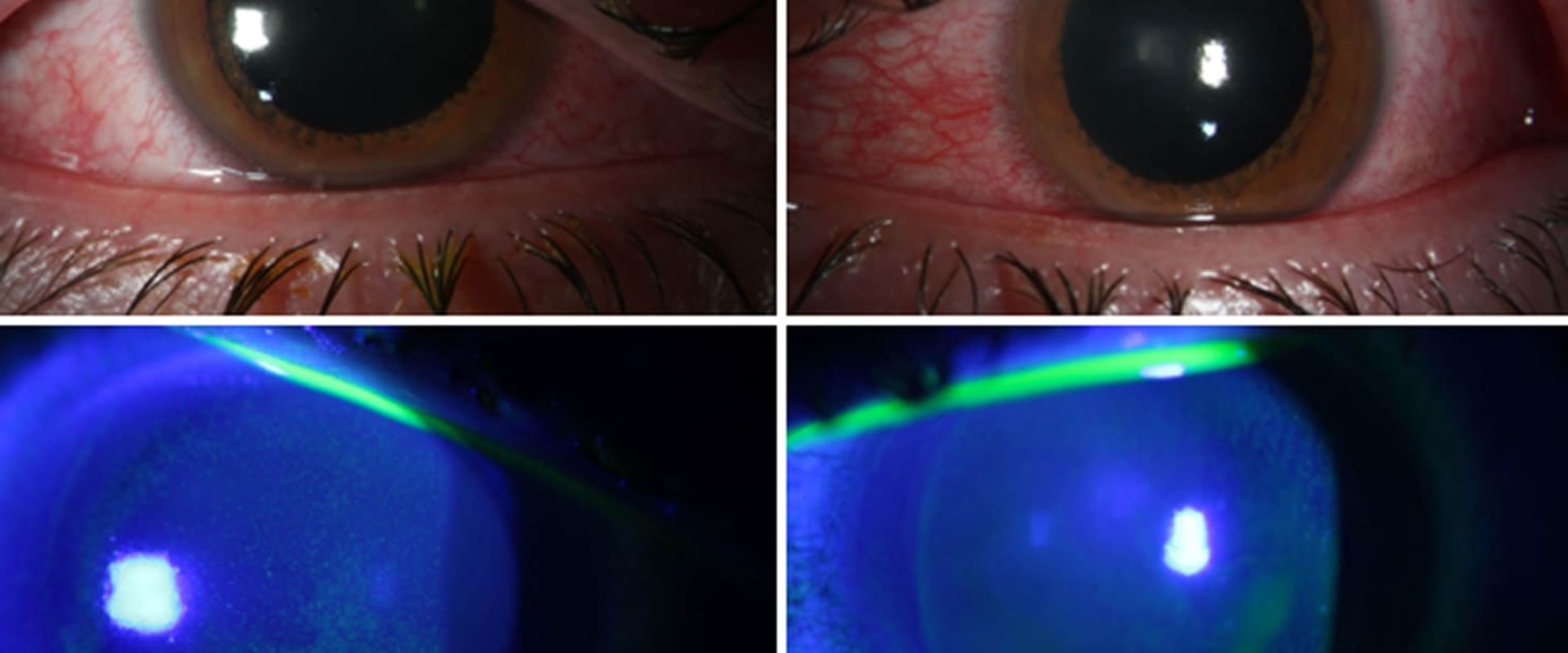 The Power of Continuous UV Light Exposure